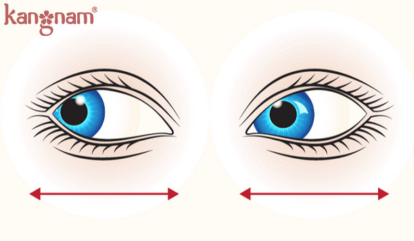 bài tập giúp giảm nhức mỏi mắt