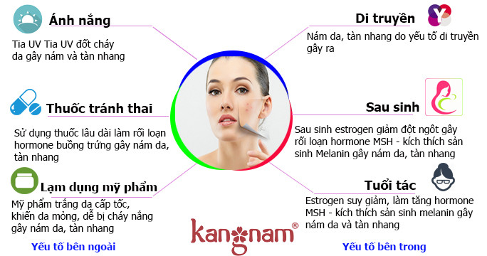 Nguyên nhân chính gây ra mụn